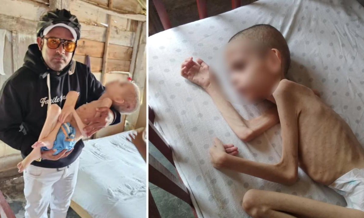 nino-cubano-con-desnutricion-severa-desata-alarma-y-moviliza-la-solidaridad-entre-cubanos
