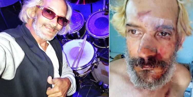Brutal asalto al baterista cubano Eduardo Longa en La Habana