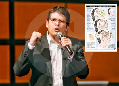 ¿Qué es un edema cerebral y por qué mantiene a Miguel Uribe Turbay en estado crítico?
