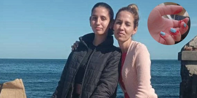 La adolescente cubana que suda sangre: “No es fácil ver a un hijo así”, dice su madre