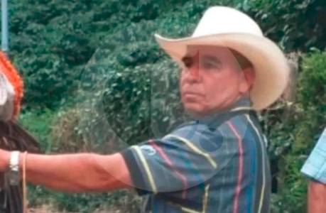 lo-mato-una-rama-cuando-talaba-otro-arbol-de-un-predio-en-el-suroeste-antioqueno