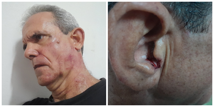 Escritor Jorge Fernández Era fue detenido y golpeado por agentes del régimen