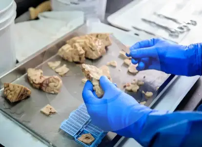 ¿que-paso-con-la-investigacion-contra-el-alzheimer-tras-un-ano-de-la-muerte-de-francisco-lopera?