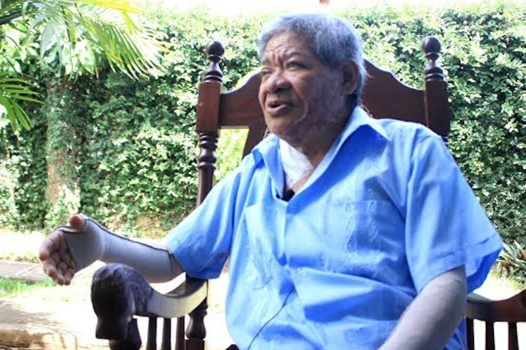 Muere sacerdote Mario Guevara, víctima de ataque con ácido en 2018