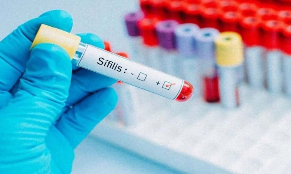 sifilis-en-cuba:-una-‘epidemia-silenciosa’-en-tiempos-de-colapso-sanitario