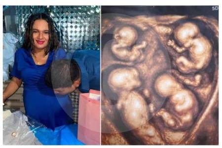 ¡Atención!: ya nacieron los cuatrillizos genéticamente idénticos provenientes de Caucasia